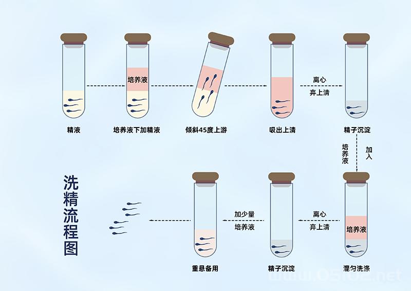 北京HIV泰国试管婴儿精子洗涤方法